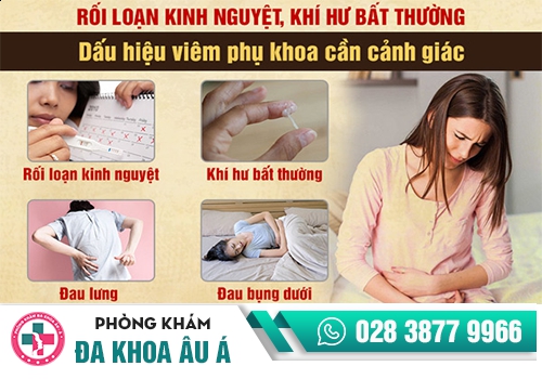 Biểu hiện kinh nguyệt không đều